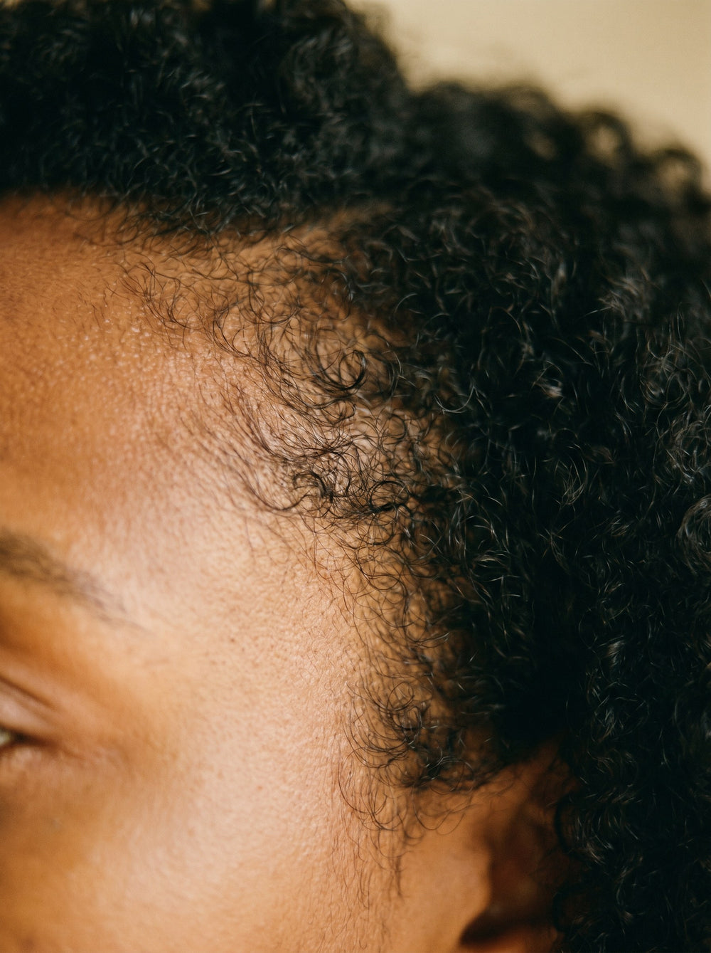 Week 6: the first hair at my temple